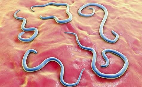 Image of roundworms