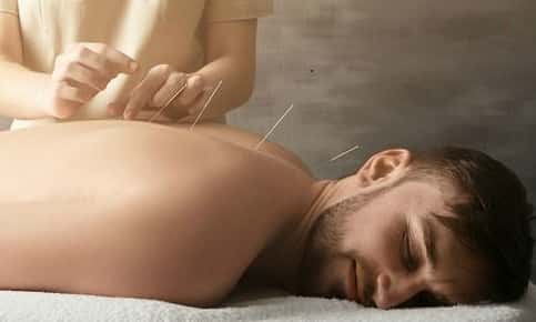 Acupuncture for Men