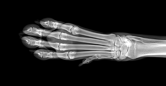 X-ray of a paw. 
