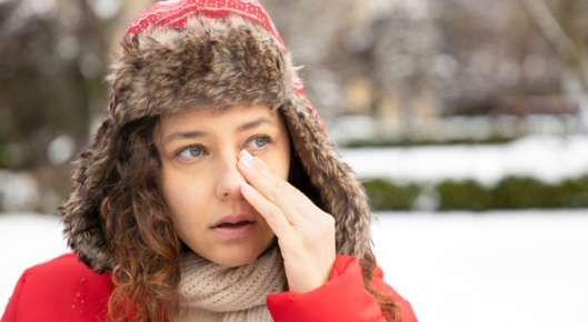 Woman deals with dry eye during the winter.