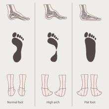 chart of a normal foot, a high arch foot, and a low arch foot