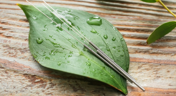 Acupuncture needles on wet leaf