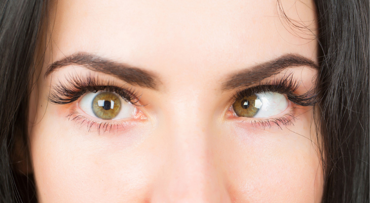 Woman with strabismus up close.