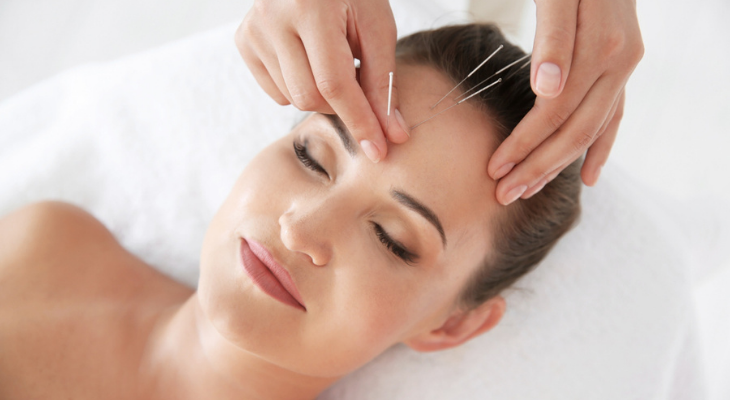 Woman getting acupuncture treatment in face 