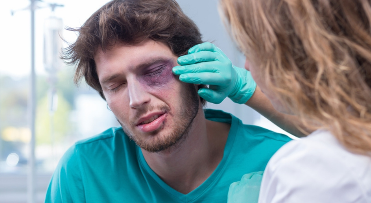 Man with black eye being checked by eye doctor