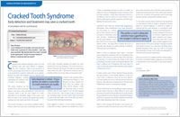 Cracked Tooth Syndrome - Dear Doctor Magazine