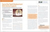 Immediate Dental Implants - Dear Doctor Magazine