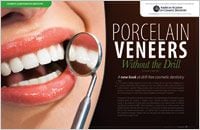 No-prep Procelain Veneers - Dear Doctor Magazine