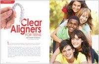 Clear Aligners for Teens - Dear Doctor Magazine