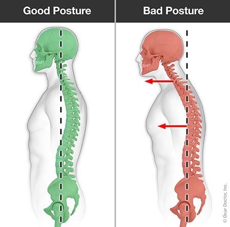 Posture - Good versus Bad.