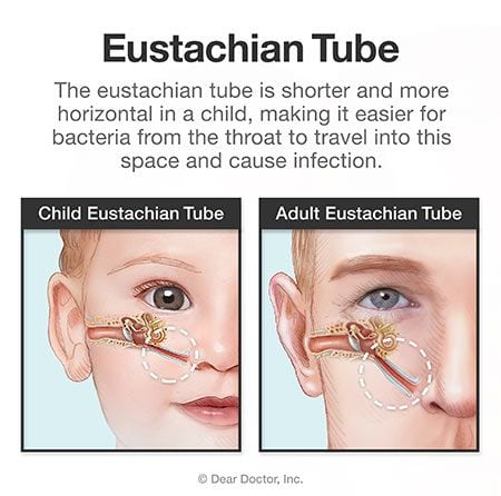 Eustachian tube - adult vs child.