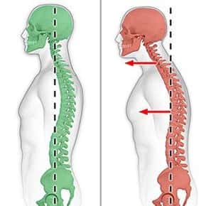 Poor Posture Affects More Than Your Appearance - Stucky Chiropractic
