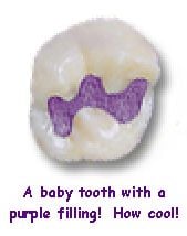 A baby tooth with a purple filling
