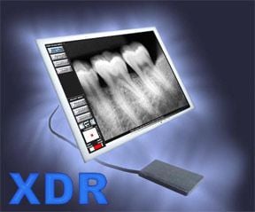 XDR Digital X-Ray
