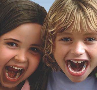 MagicFil Tooth Colored Fillings for Kids
