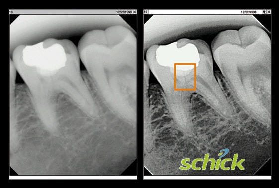 Schick X-ray