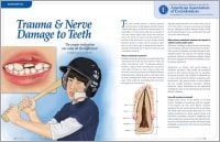 Trauma and Nerve Damage to Teeth - Dear Doctor Magazine