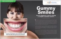 Gummy Smiles - Dear Doctor Magazine