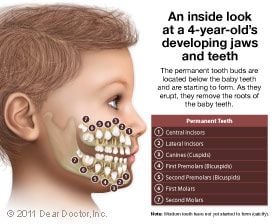 Kids developing jaws and teeth.