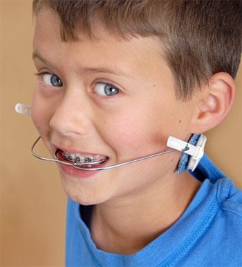 Child wearing orthodontic headgear.