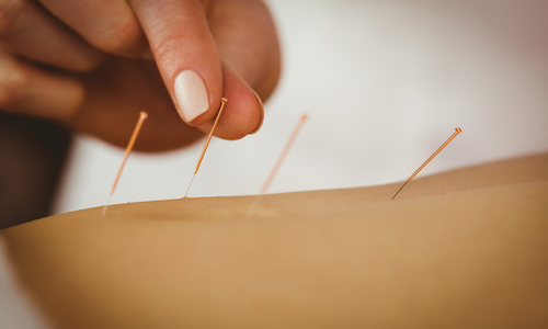 Acupuncture for indigestion