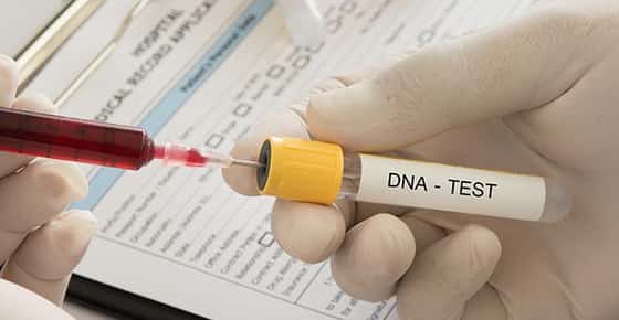 Image of a DNA sample. 