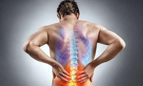 Natural Remedies for Sciatic Pain, Chiropractor in Orange City, FL