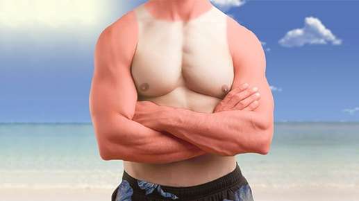 Image of a man's chest with a tank top, sunburn. 