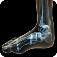 x-ray image of a foot