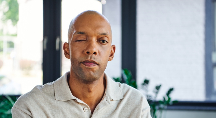 Man with ptosis poses for picture.