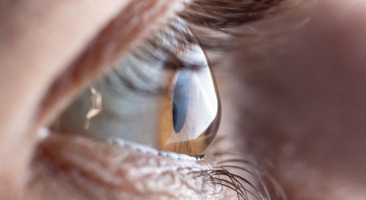 Your Blurry Vision Could Be Caused by Astigmatism | Optometrist in ...