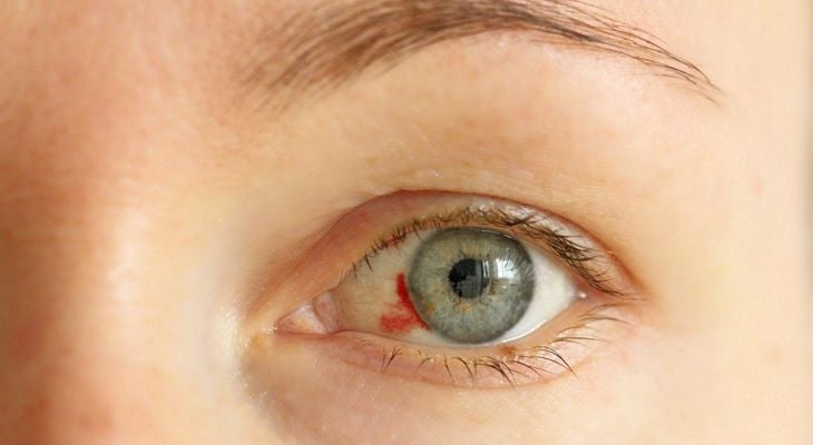 Eye Occlusions