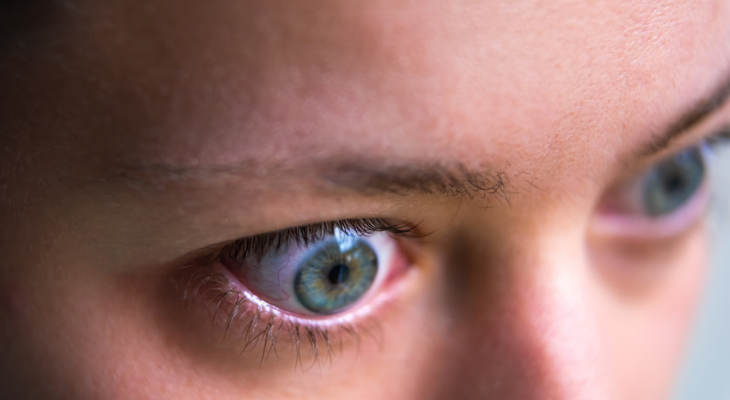 What Is a Black Eye? - American Academy of Ophthalmology