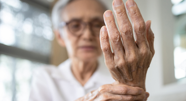 Old woman with arthritis. 