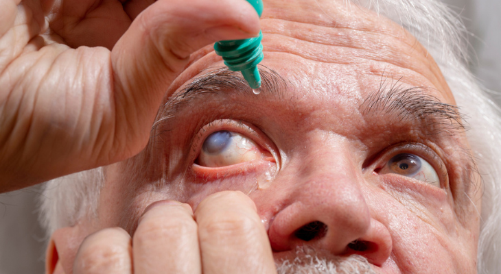 Old man puts drops in his eye.