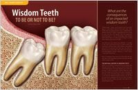 Wisdom Teeth - Dear Doctor Magazine