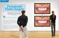 Periodontal Plastic Surgery - Dear Doctor Magazine