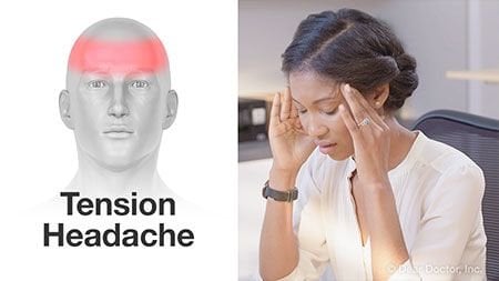 Tension headache Chiropractic Basalt Aspen Carbondale