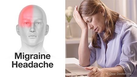 Migraine headache Chiropractic Basalt Aspen Carbondale