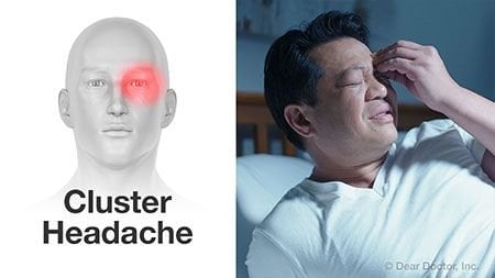 Cluster headache Chiropractic Basalt Aspen Carbondale