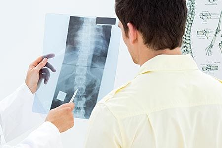 x-rays in chiropractic care.