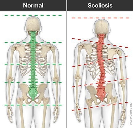 Scoliosis Department - Mobility Medclinic Inc