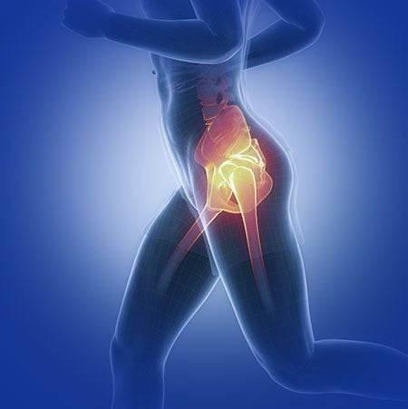 Hip Pain Relief Chicago  Hip Pain Treatments - MAPS