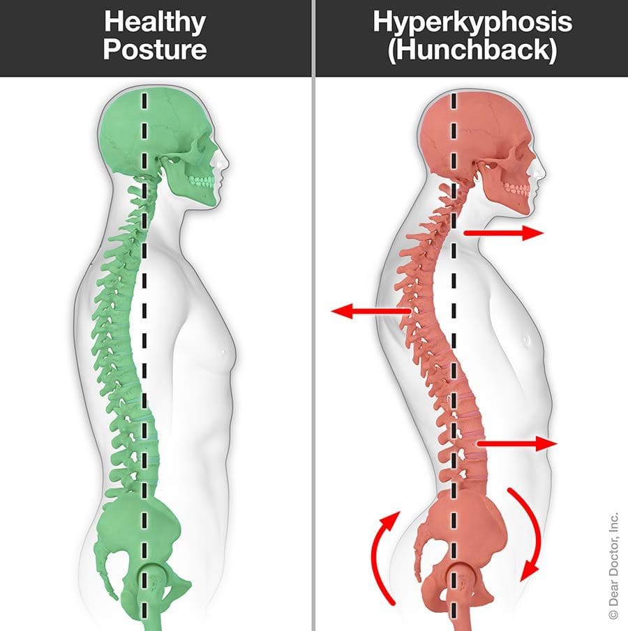 Posture Problems Chiropractor In Richmond Va Winston Chiropractic Care Pc 9040