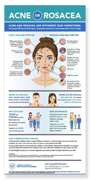 acne-or-rosacea-infographic-thumbnail.jpg