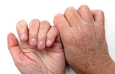 anti-aging-skin-care-rough-hands.jpg
