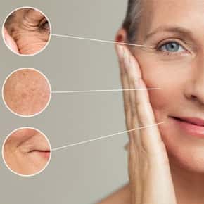 The Bronzed Age: 3 Ways to Prevent Wrinkles Caused By Going to the Tanning  Salon - Cosmetic Surgeons of Michigan, P.C.
