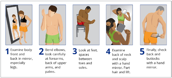 How to examine your skin