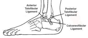 Ankle Ligament Injury - OrthoWashington