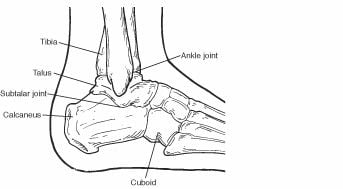 Broken Ankle Basics  Podiatry Associates, INC.